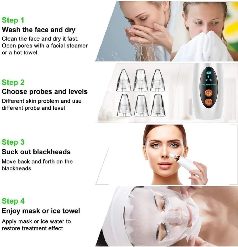 Electric Blackhead Remover
