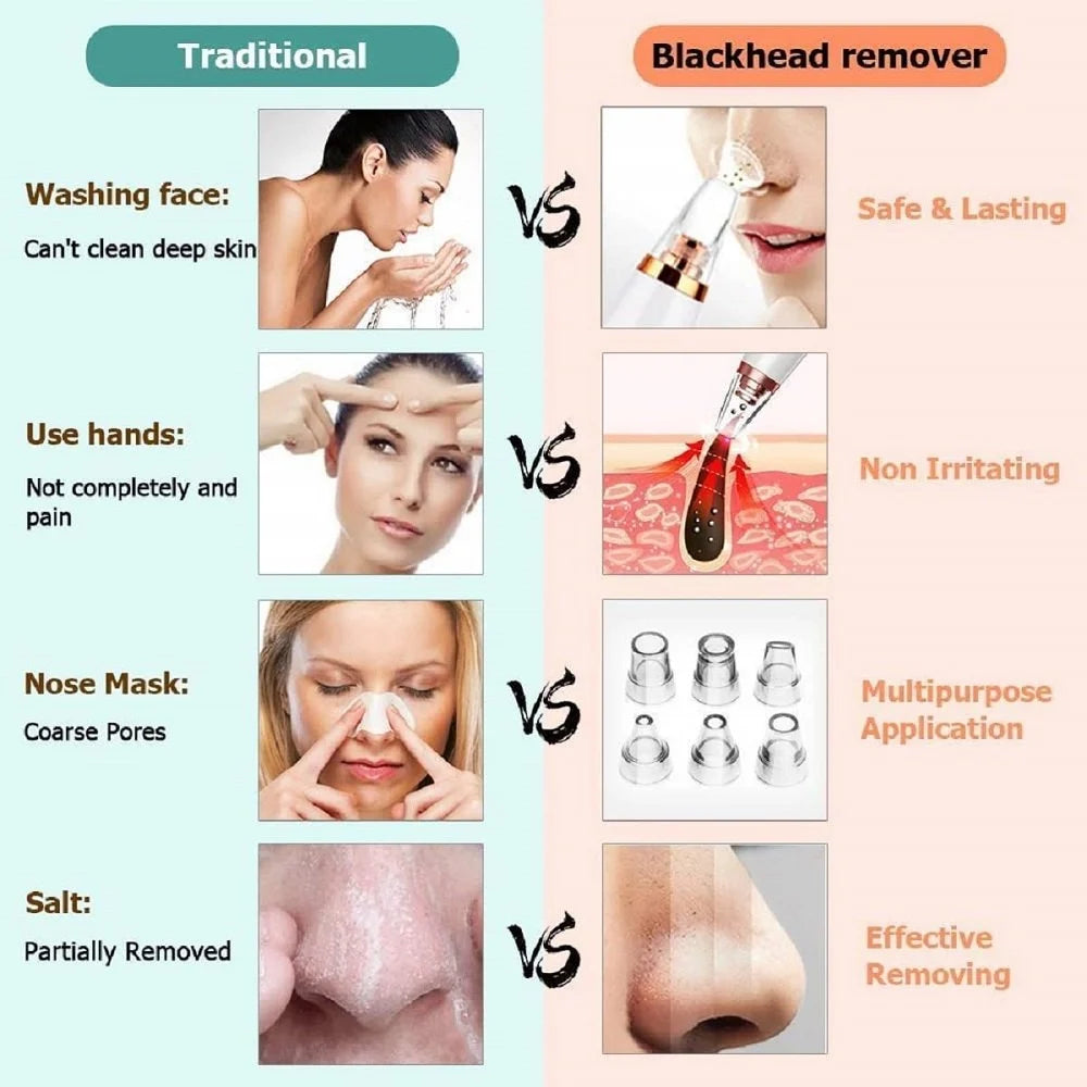Electric Blackhead Remover