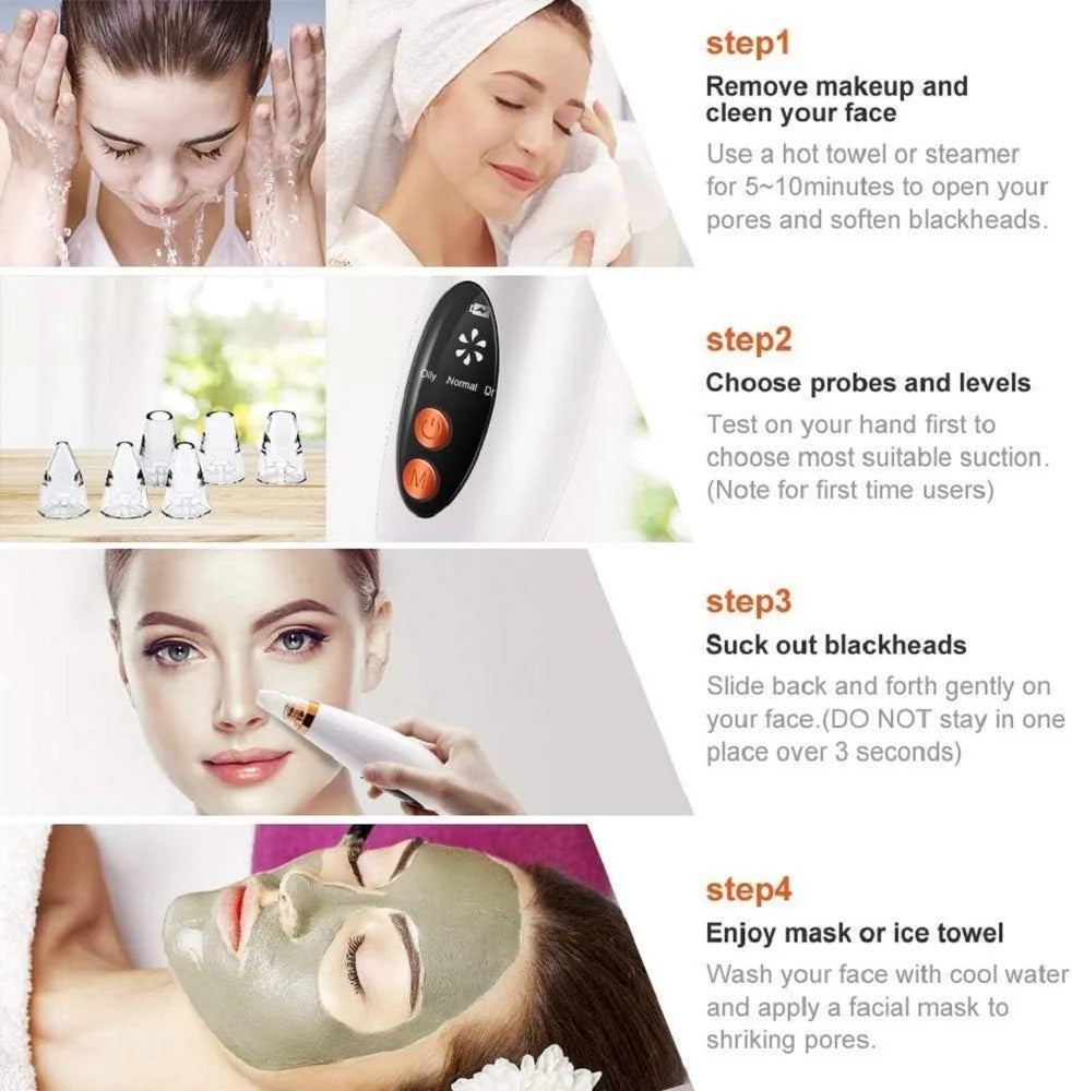 Electric Blackhead Remover
